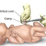Newborn Umbilical Cord